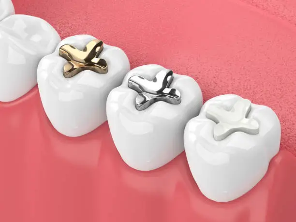 DMLS Crowns